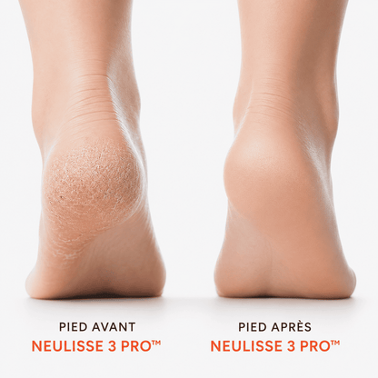 Neulisse 3 Pro™