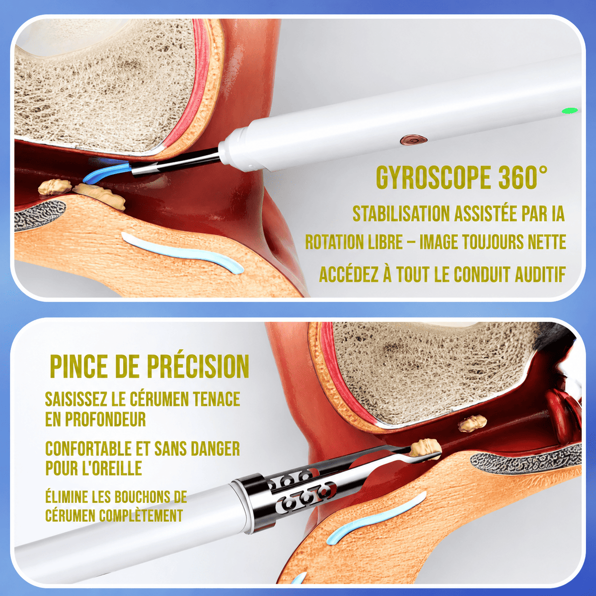 Nuvergo VisioEar™ : Technologie pour la santé des oreilles approuvée par les médecins